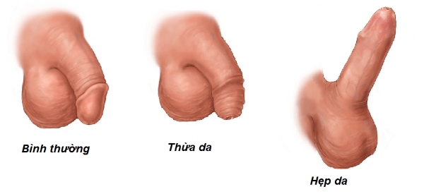 Bao quy đầu là vùng da mỏng chứa nhiều dây thần kinh