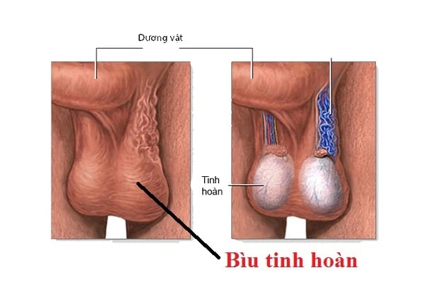 Bìu và tinh hoàn là những điểm G không thể bỏ qua