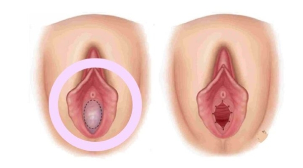 Quan hệ lần đầu có đau không?
