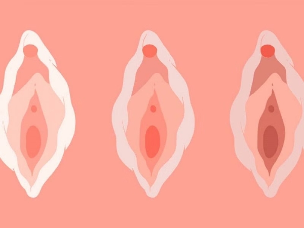 Sau khi quan hệ lần đầu, vùng kín có bị thay đổi hình dạng không?