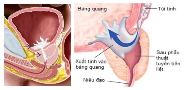 Bế tinh đại pháp là gì?